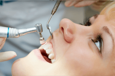 Teeth-Cleaning&Polishing-Dental-treatments-https://lylaclinic.com/